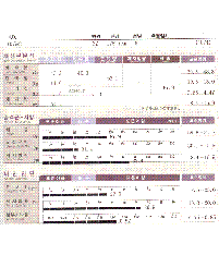 전후사진