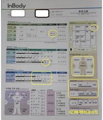 치료 전