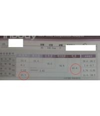 치료 후
