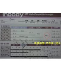치료 전