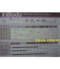 치료 후