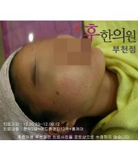 치료 후