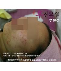 치료 전