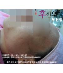 치료 후