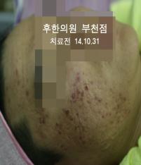 치료 전
