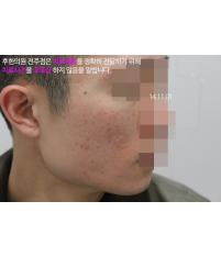치료 후