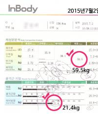 치료 전