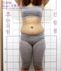 치료 전