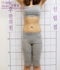 치료 후