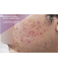 치료 전