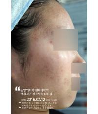 치료 후