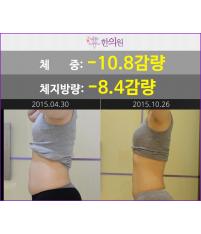 치료 후