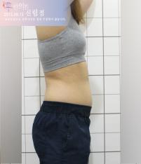 치료 전