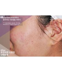 치료 후