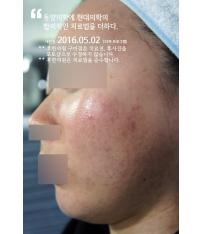 치료 후