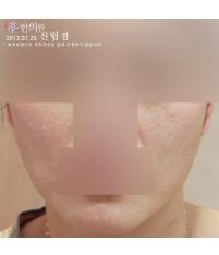 치료 후