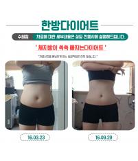 전후사진