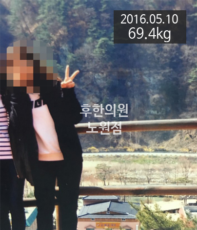 치료 전