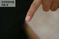 치료 후