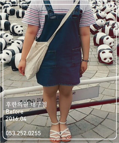 치료 전