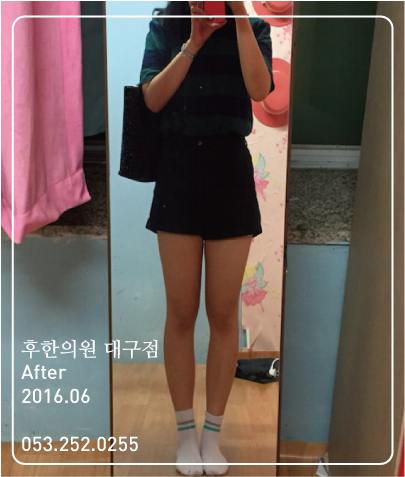 치료 후