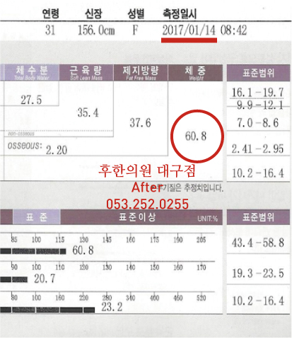 치료 후