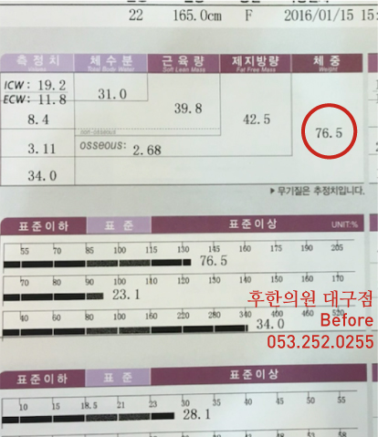 치료 전
