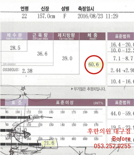 치료 전