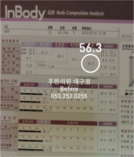 치료 전