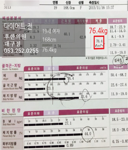 치료 전