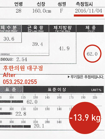 치료 후