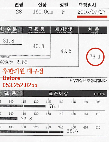 치료 전