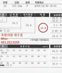 치료 후