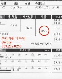 치료 전