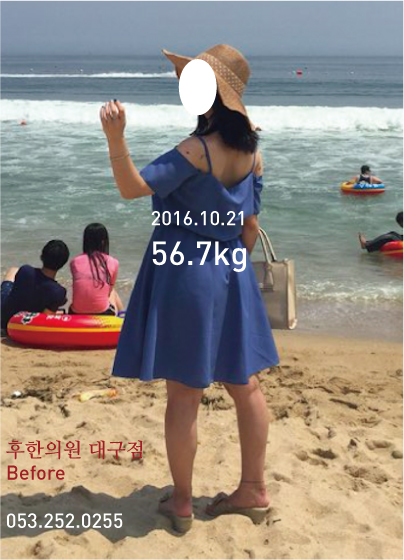 치료 전