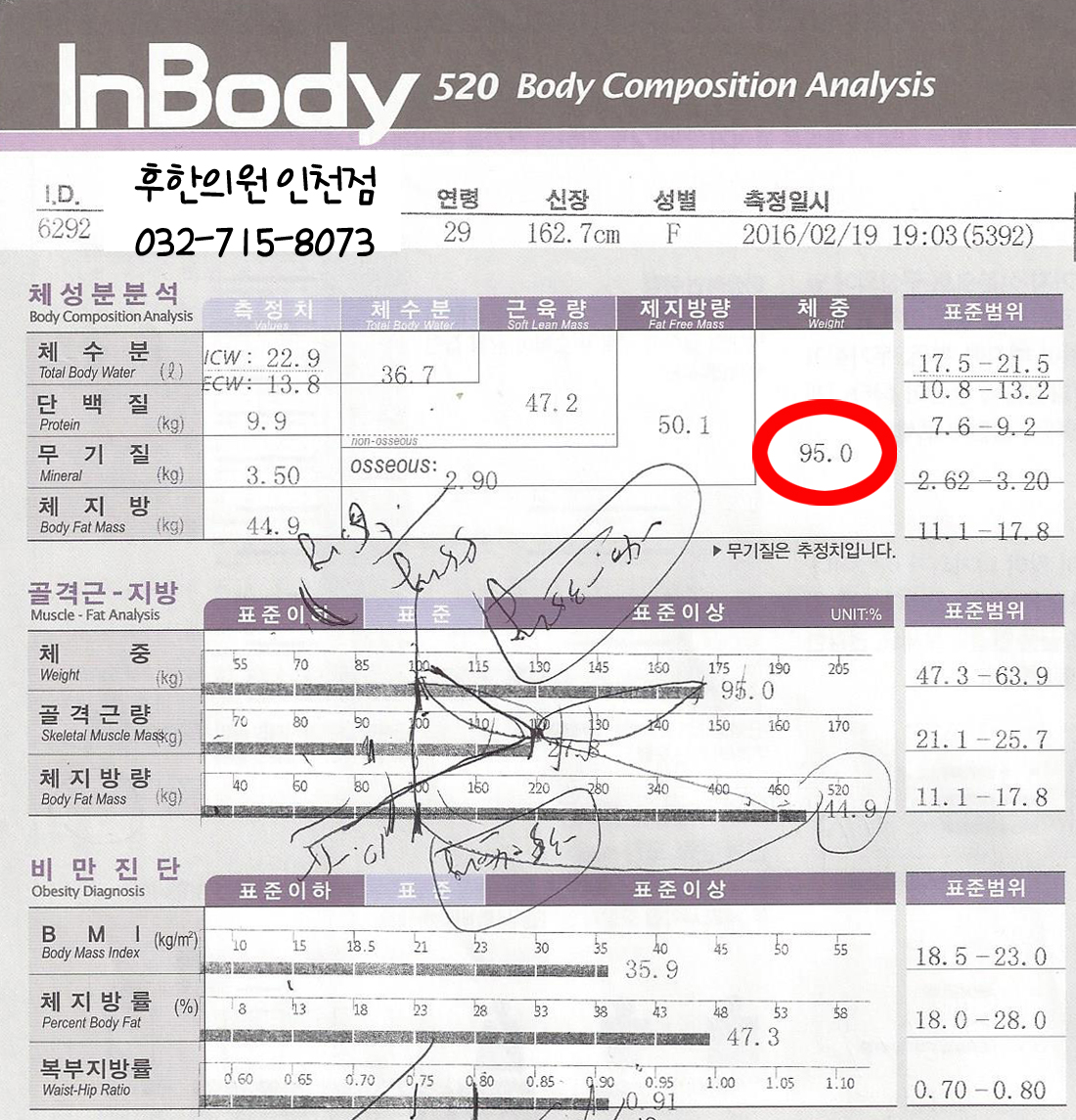 치료 전