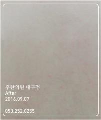 치료 후
