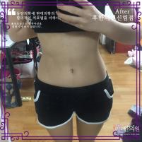 치료 후
