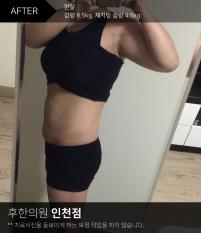 치료 후