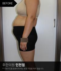 치료 전