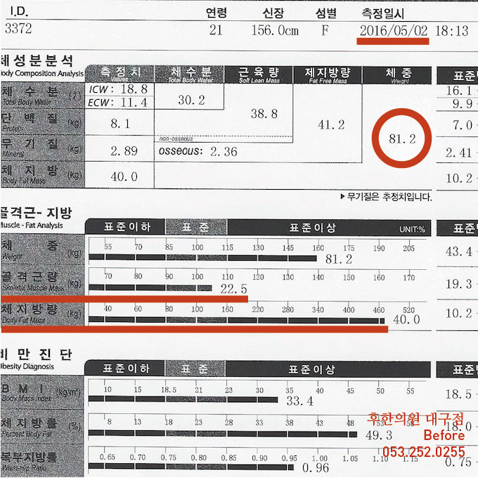 치료 전