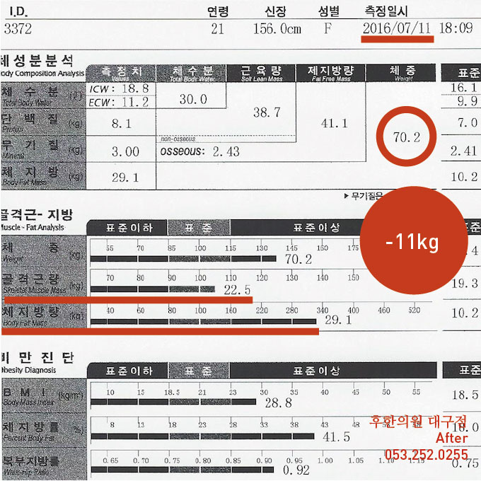 치료 후