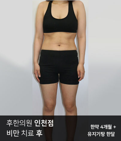 치료 후