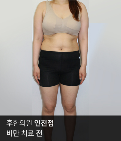 치료 전