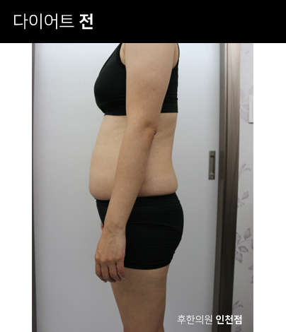 치료 전