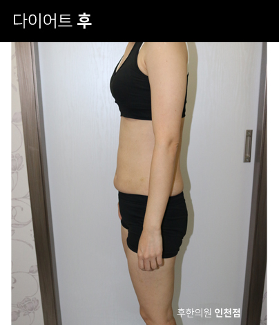 치료 후