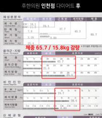 치료 후