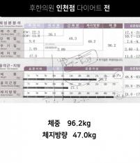 치료 전