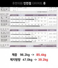 치료 후