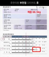 치료 후
